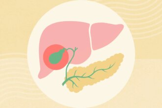 What Is Acalculous Cholecystitis?