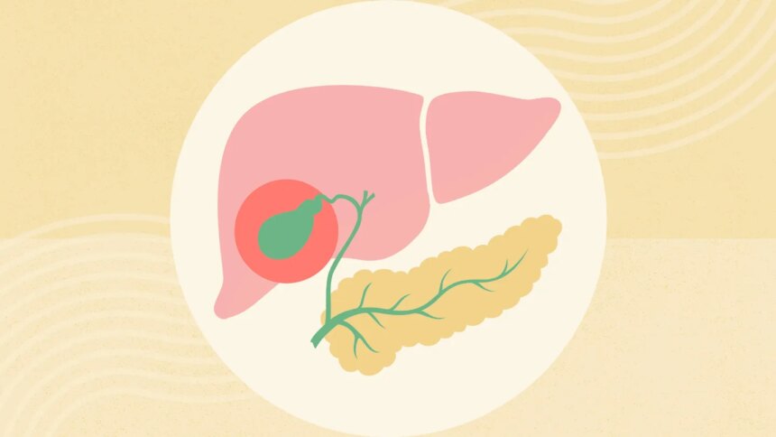 What Is Acalculous Cholecystitis?