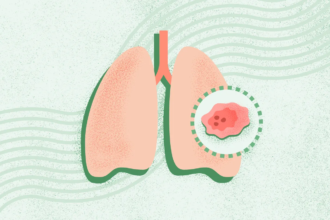 What Is Lung Cancer?