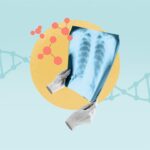 Is Lung Cancer Hereditary?