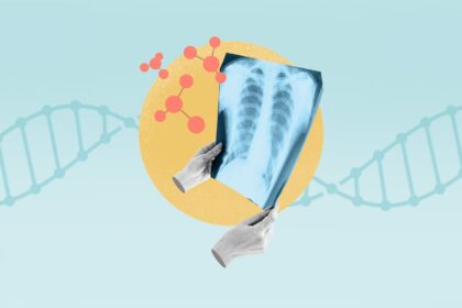 Is Lung Cancer Hereditary?