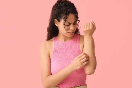 Cucumber to coriander: 10 home remedies for heat rash to soothe your skin
