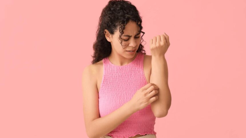Cucumber to coriander: 10 home remedies for heat rash to soothe your skin