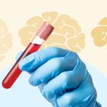 A Basic Blood Test Could Predict How Fast You’ll Lose Memory From Alzheimer’s