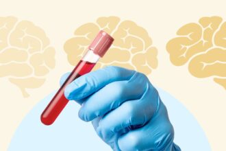 A Basic Blood Test Could Predict How Fast You’ll Lose Memory From Alzheimer’s