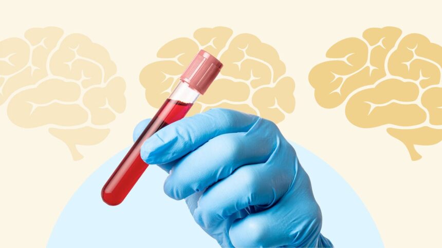 A Basic Blood Test Could Predict How Fast You’ll Lose Memory From Alzheimer’s
