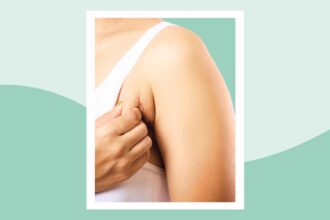 What Is Armpit Rash?