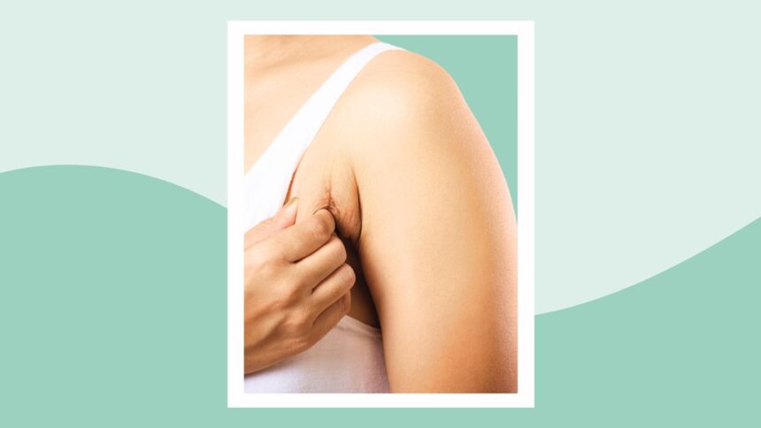 What Is Armpit Rash?