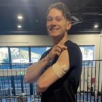 Lachie Kennedy shows his left arm with CGM sensor while lifting his black tshirt sleeve.