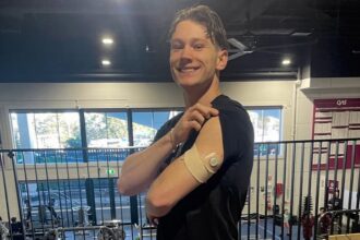 Lachie Kennedy shows his left arm with CGM sensor while lifting his black tshirt sleeve.
