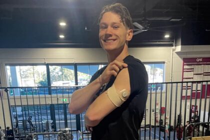 Lachie Kennedy shows his left arm with CGM sensor while lifting his black tshirt sleeve.