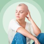 Causes and Risk Factors of Alopecia Areata
