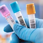 How Is Hereditary Angioedema (HAE) Diagnosed?