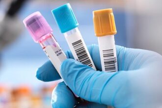 How Is Hereditary Angioedema (HAE) Diagnosed?