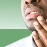Black man concerned about a blister on his lip