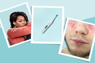 Lupus Symptoms