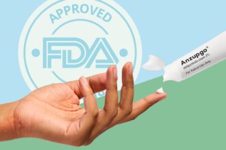 New Cream Is the First of Its Kind for Chronic Hand Eczema