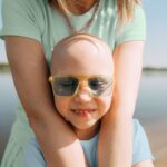5 Things to Know About Alopecia in Children