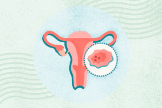 What Is Uterine (or Endometrial) Cancer?