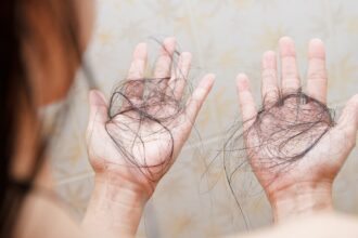 International Alopecia Day 2025: Cosmetic surgeon explains why autoimmune hair loss is rising