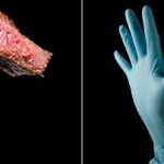 7 Surprising Triggers of Anaphylaxis