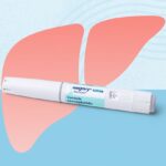 People With Weight-Related Chronic Liver Disease Have a New Treatment Option